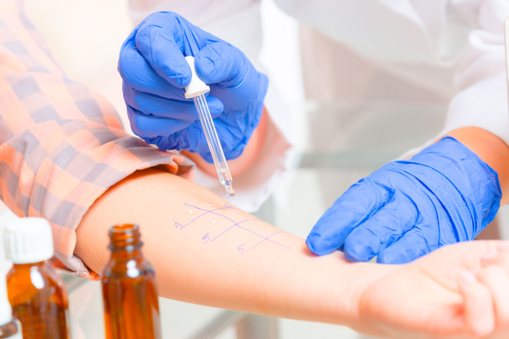 Treatment of allergy in Germany Treatment of allergy in Germany