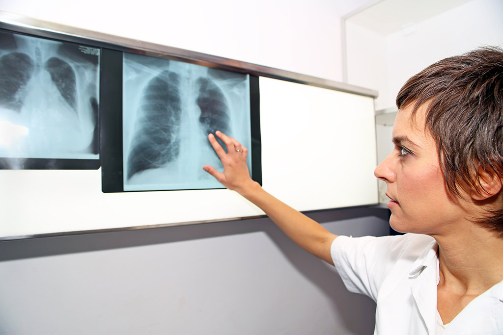 Pulmonary hypertension diagnostics Pulmonary hypertension diagnostics