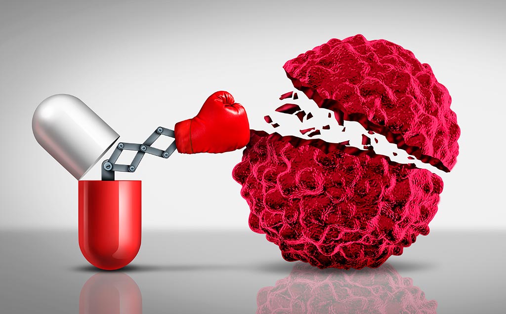 Opdivo. New Treatment of the Lung Cancer Opdivo. New Treatment of the Lung Cancer