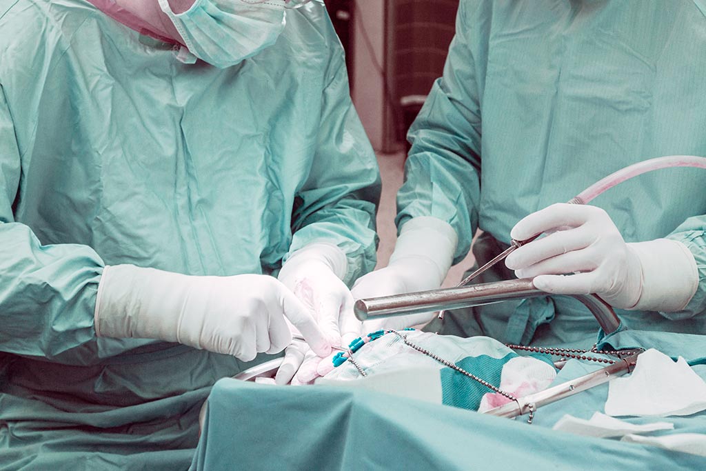 Benefits of endoscopic neurosurgery Benefits of endoscopic neurosurgery