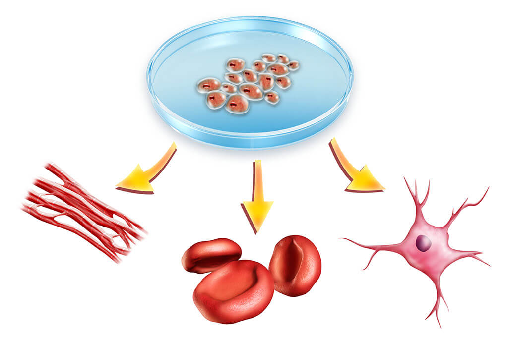 Методы лечения стволовыми клетками