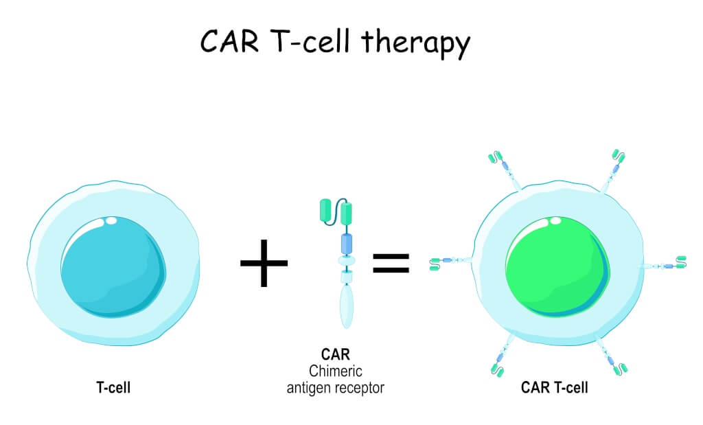 CAR T-клеточная терапия