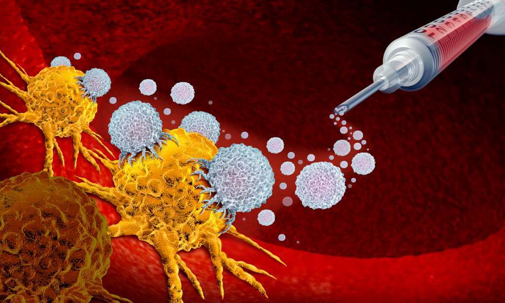 Лечение рака поджелудочной железы дендритными клетками в Германии