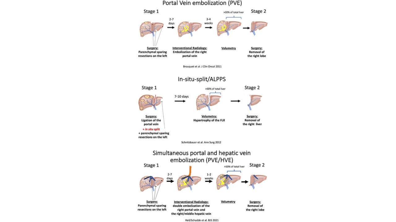 Type of procedures