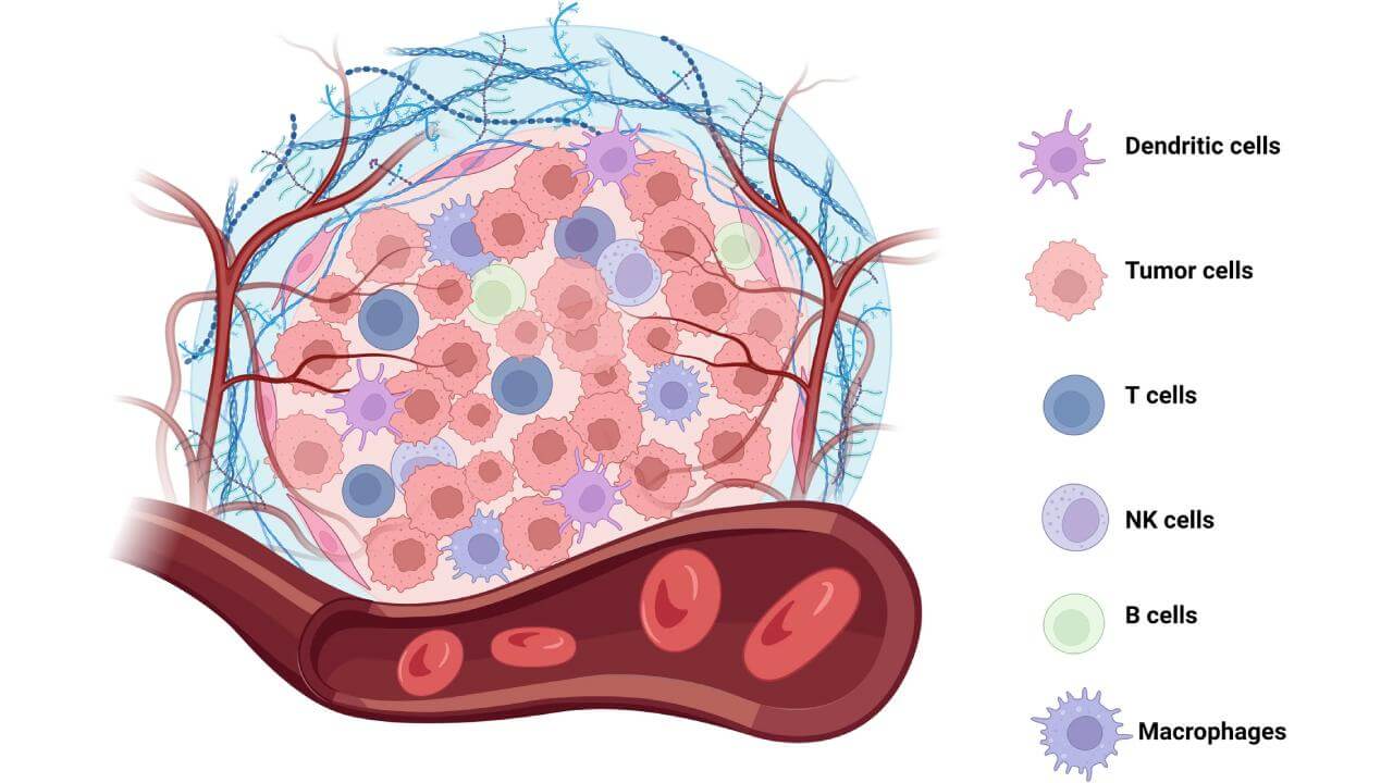 Evolution of cell therapy for renal cell carcinoma