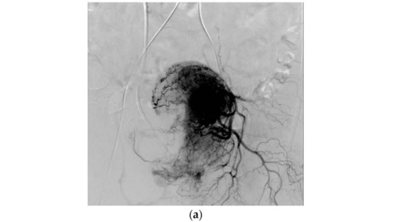 Angiographic image