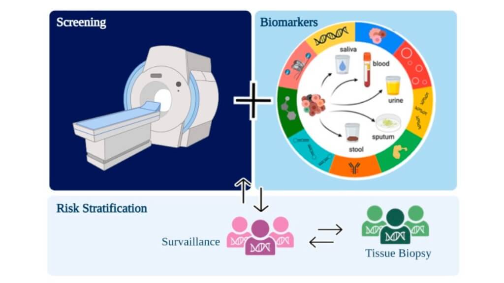 Purposed workflow for lung cancer screening programs associating low-dose computed tomography (LDCT) and minimally invasive biomarkers