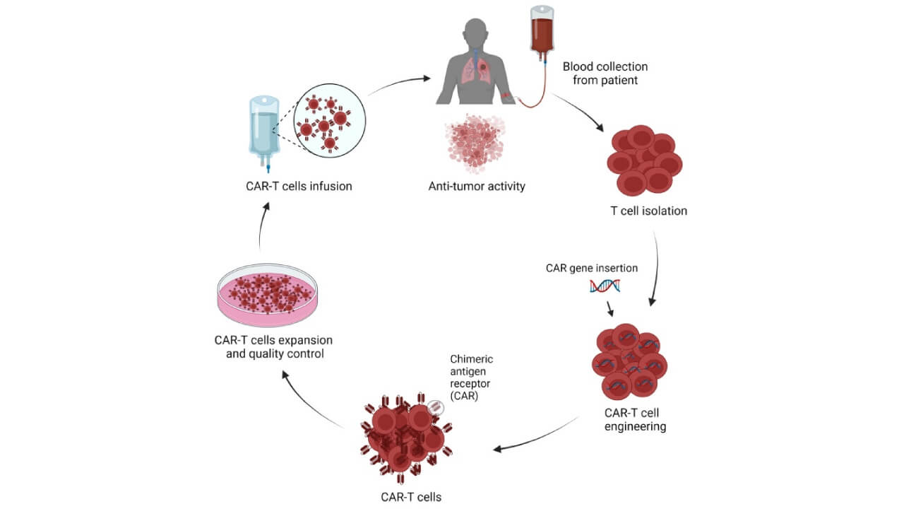 Schematic representation of CAR-T cells production and application in lung cancer treatment