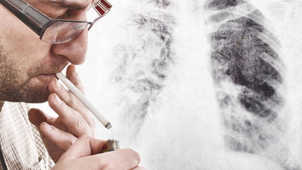 Smoking is the cause of lung cancer