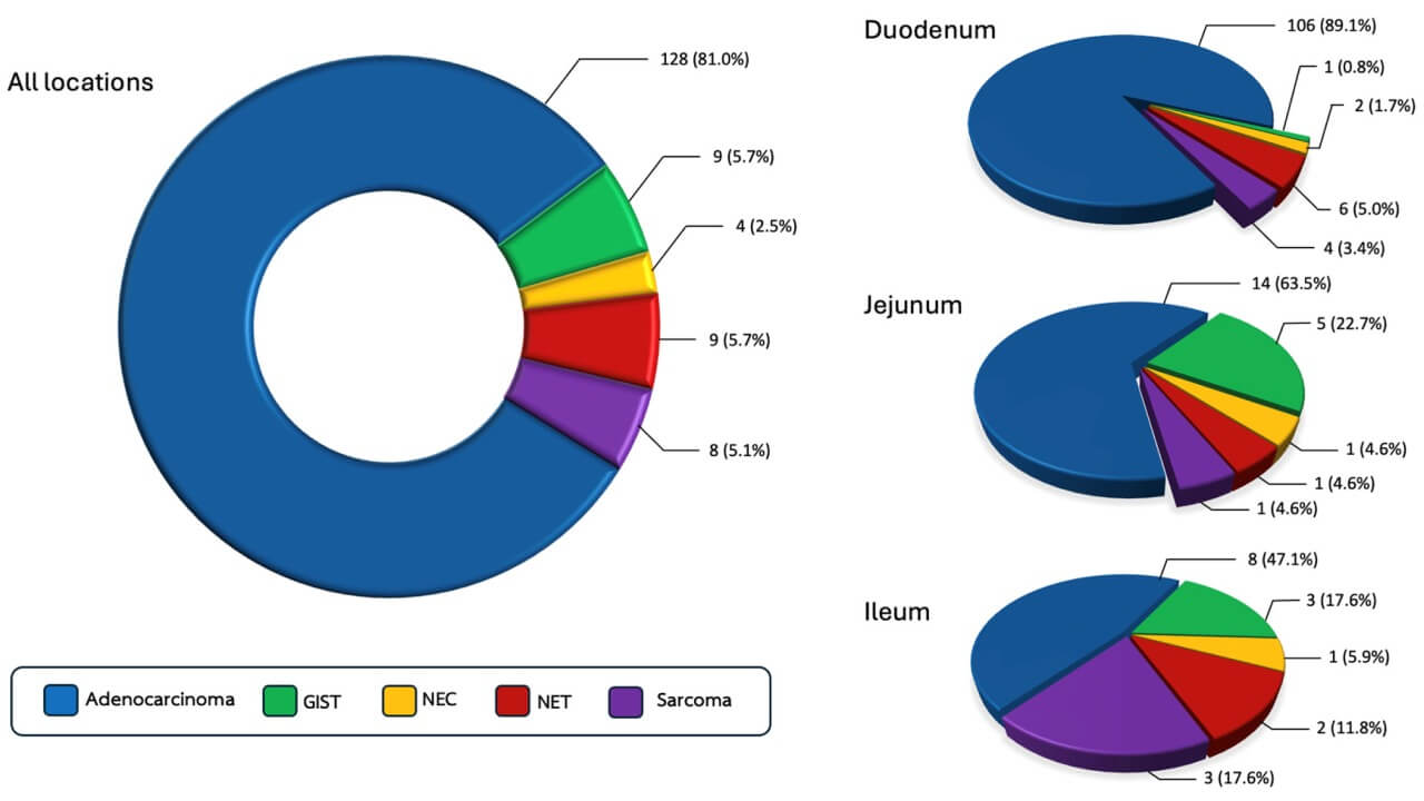 Prevalence of small bowel cancer depending on the histological subtype and location of the primary tumor