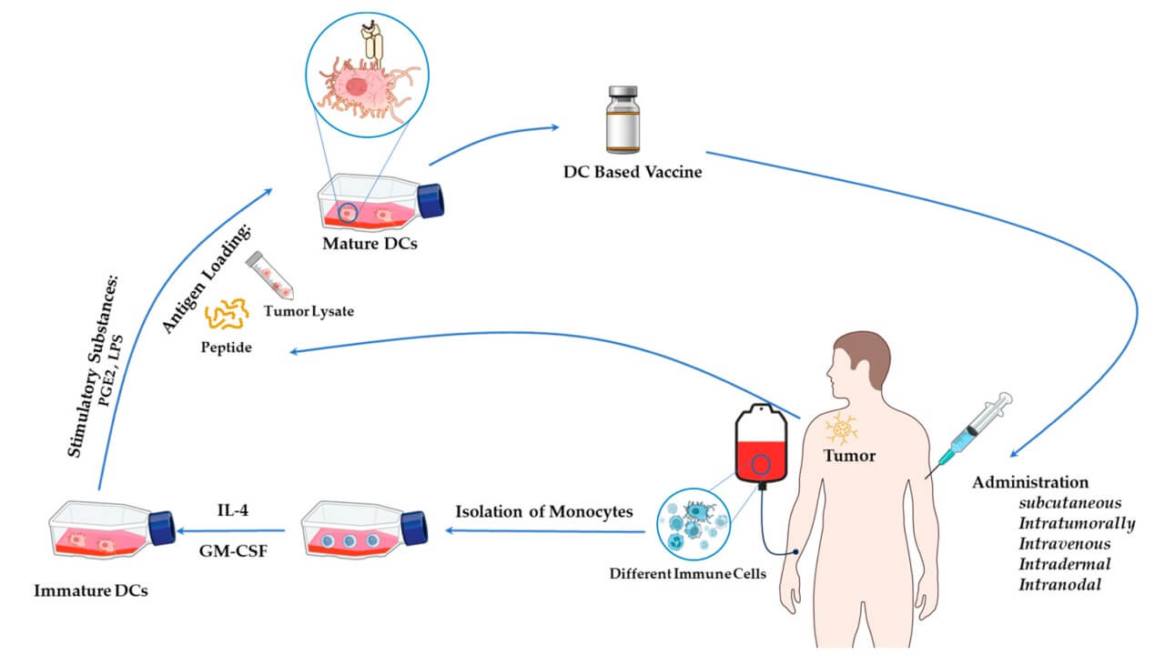 الإجراء القياسي لإنتاج لقاحات الخلايا المتغصنة (DC vaccines)