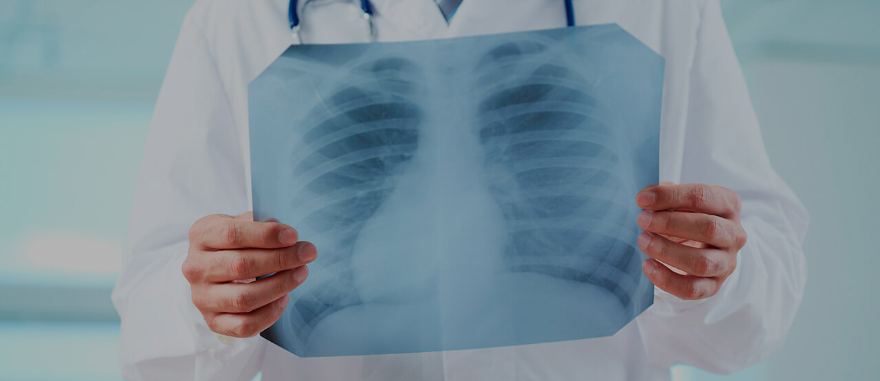 Diagnostics of lung cancer